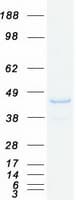 Human SNX16 Protein (Recombinant Myc-DDK (Flag))