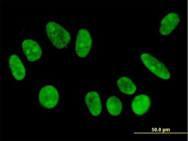 IHC-plus™ FBXO11 Antibody (clone 4C12)