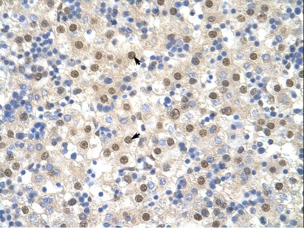 TDP-43 / TARDBP Antibody (N-Terminus)