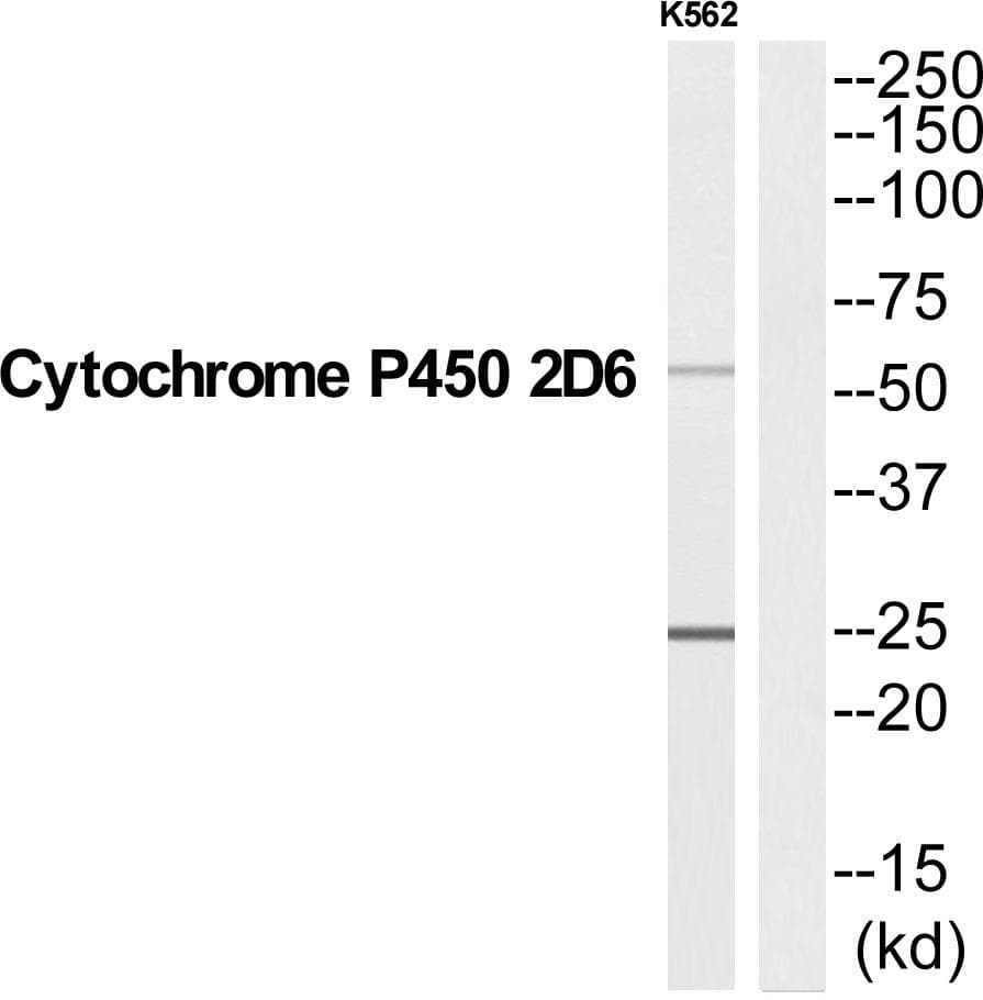 Polyclonal Rabbit anti-Human CYP2D6 Antibody (WB)