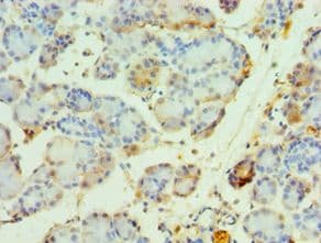 ARA70 / NCOA4 Antibody (aa1-280)