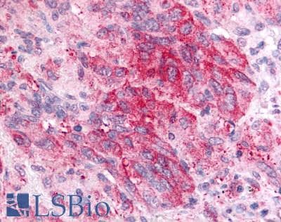 PathPlus™ Polyclonal Rabbit anti-Human PGES / PTGES Antibody (Cytoplasmic Domain, IHC)