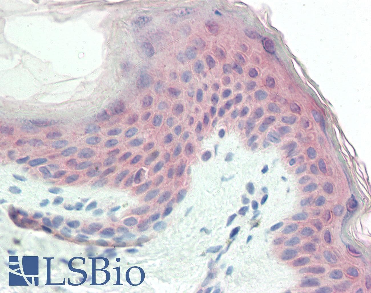 Polyclonal Rabbit anti-Human TRIM29 Antibody (C-Terminus, IHC, WB)