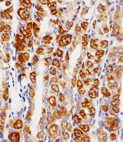 Monoclonal Mouse anti-Human EGFR Antibody (aa1163-1191, IHC, WB)