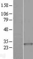 ARHGEF38 / FLJ20184 Protein (Over-Expression Lysate Myc-DDK (Flag))