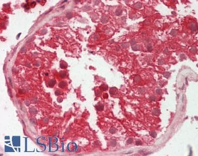 IHC-plus™ CLC-7 / CLCN7 Antibody (aa10-59)