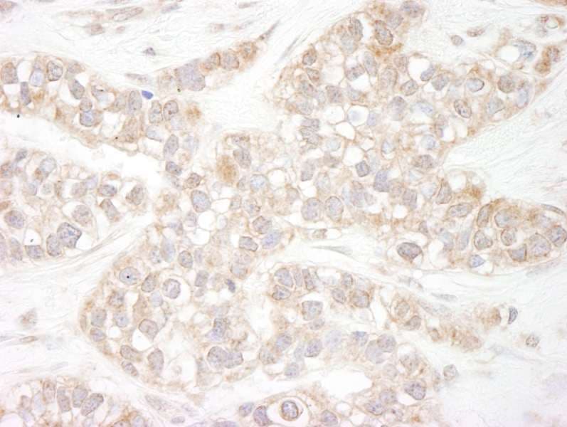 Polyclonal Rabbit anti-Human FLII / FLI Antibody (aa425-475, IHC, WB)