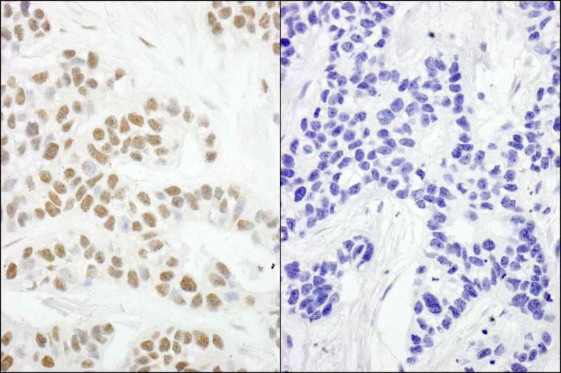 Polyclonal Rabbit anti-Human RPA2 / RFA2 / RPA34 Antibody (phospho-Ser4/8, IHC, IF)