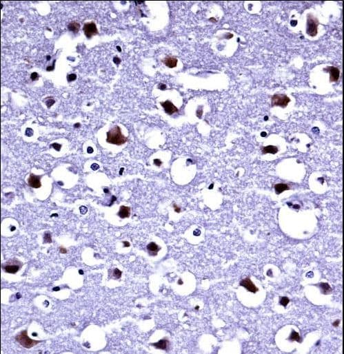 Polyclonal Rabbit anti-Human TARBP2 / TRBP2 Antibody (aa60-89, IHC, WB)