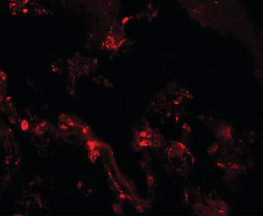 IHC-plus™ Polyclonal Rabbit anti-Human TM4SF1 Antibody (IHC, IF, WB)