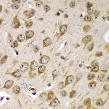 TMED10 / TMP21 Antibody