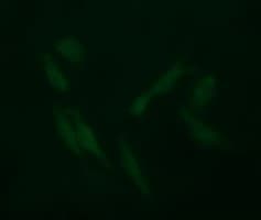 FCGR1A / CD64 Antibody (clone OTI3H9)