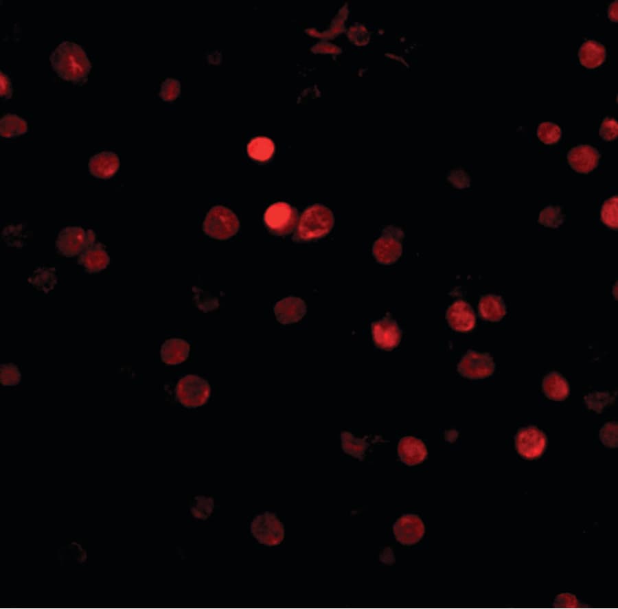 Polyclonal Rabbit anti-Human RIMS3 Antibody (IHC, IF, WB)