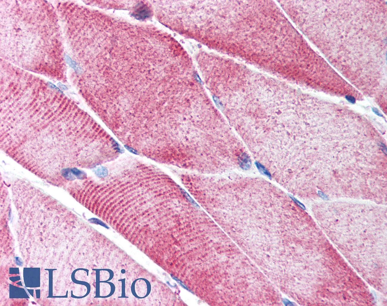 PathPlus™ Polyclonal Rabbit anti-Human ACTA2 / Smooth Muscle Actin Antibody (N-Terminus, IHC)