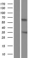CT47A10 Protein (Over-Expression Lysate Myc-DDK (Flag))