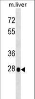 Polyclonal Rabbit anti-Mouse HOXB5 Antibody (aa1-30, WB)