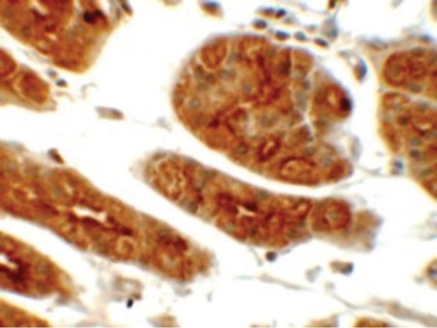 SGK1 / SGK Antibody