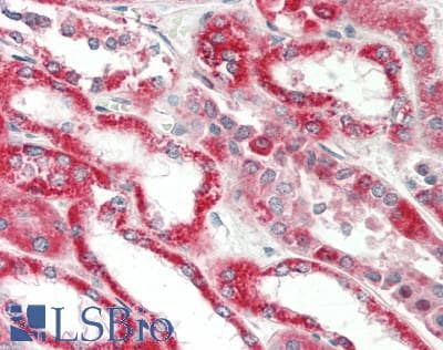 IHC-plus™ PRDX5 / Peroxiredoxin 5 Antibody