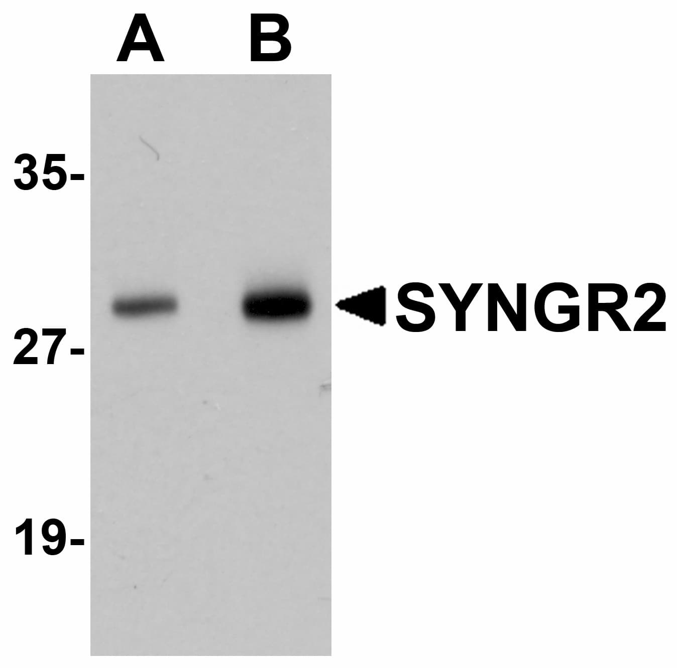 IHC-plus™ SYNGR2 / Synaptogyrin 2 Antibody