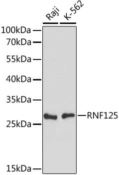 RNF125 / TRAC-1 Antibody