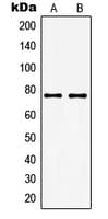GUCY1A1 / GUCY1A3 Antibody (Internal)