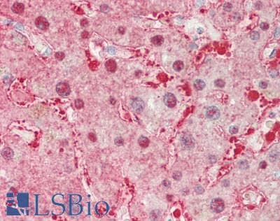 ALDOB Antibody (N-Terminus)