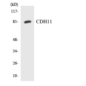 Polyclonal Rabbit anti-Human CDH11 / Cadherin 11 Antibody (aa395-444, WB)