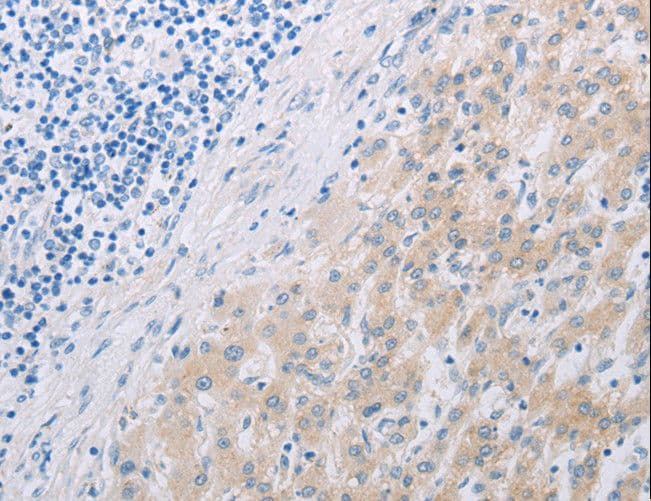 Polyclonal Rabbit anti-Human PFN2 / Profilin 2 Antibody (IHC, WB)