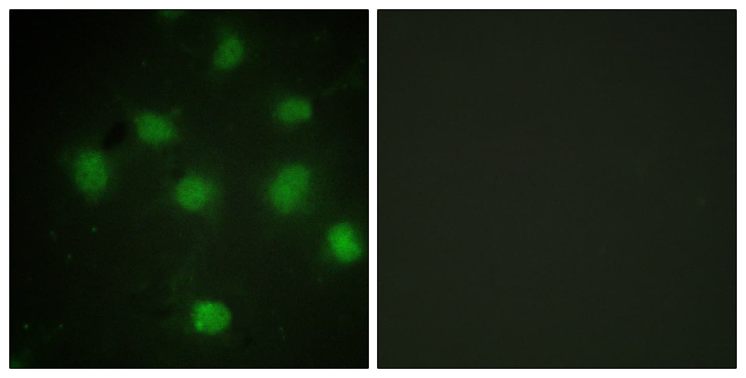 IHC-plus™ TLK1 Antibody (aa730-779)