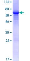 Human FAH Protein (Recombinant GST)