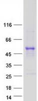 Human TAPBP / Tapasin Protein (Recombinant Myc-DDK (Flag))