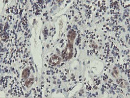 OTUB1 / OTU1 Antibody (clone OTI5B8)