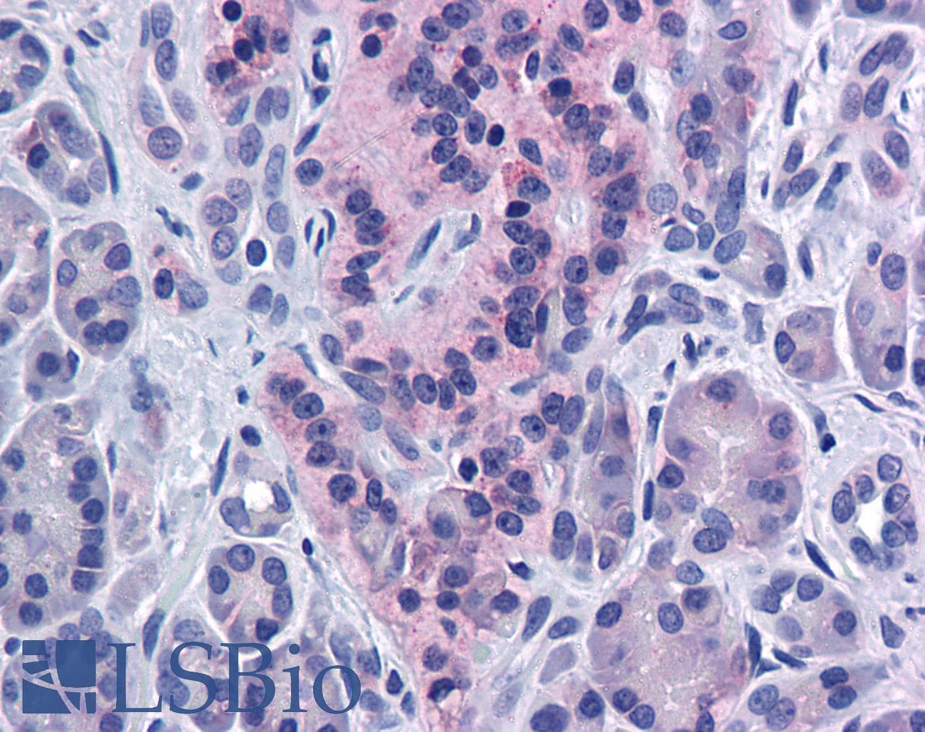 Polyclonal Rabbit anti-Human SIRT4 / Sirtuin 4 Antibody (aa216-265, IHC, WB)