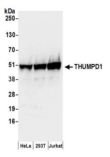 THUMPD1 Antibody (aa303-353)