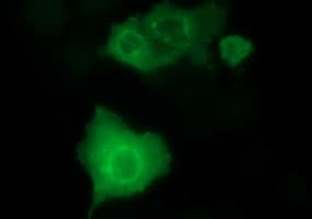 Monoclonal Mouse anti-Human MAP2K1 / MKK1 / MEK1 Antibody (clone OTI9E9, IHC, IF, WB)