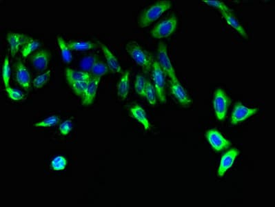 Polyclonal Rabbit anti-Human FAR2 Antibody (IHC)