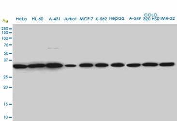 Monoclonal Mouse anti-Human SPT3 / SUPT3H Antibody (clone 1A6, WB)