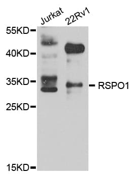 IHC-plus™ RSPO1 / RSPO Antibody