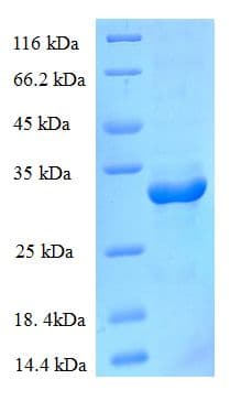 Human CNBP / ZNF9 Protein (Recombinant His-SUMO)