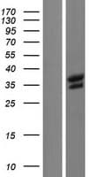 BRCC3 / BRCC36 Protein (Over-Expression Lysate Myc-DDK (Flag))