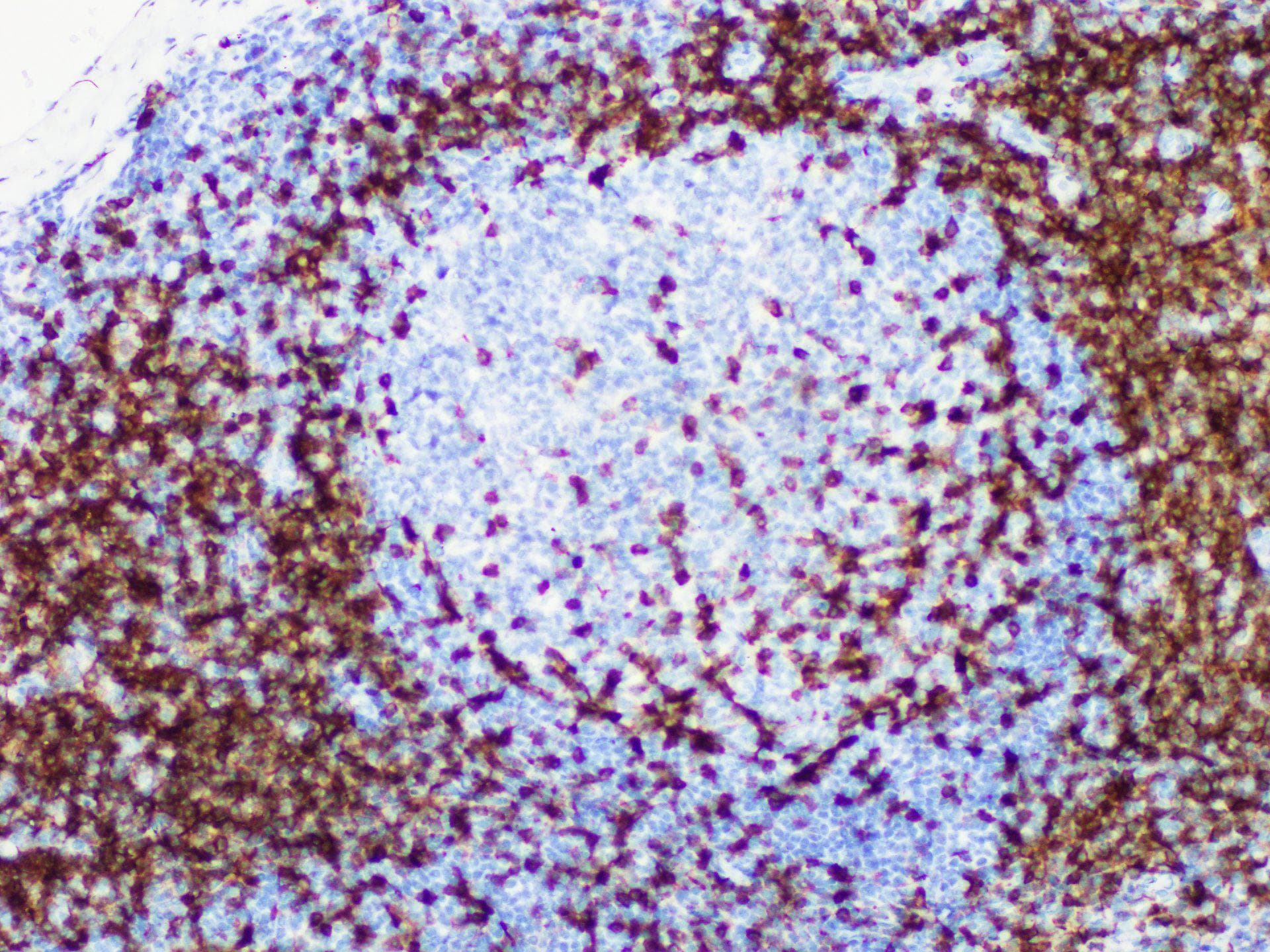 CD5 Antibody