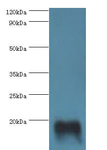 IHC-plus™ TNNC2 Antibody (aa1-160)