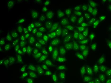 COIL / Coilin Antibody