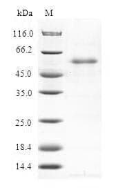 Human RNF114 / ZNF313 Protein (Recombinant GST, N-terminus)
