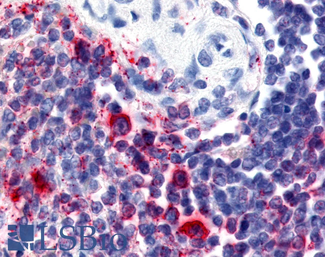 IHC-plus™ ATRN / Attractin Antibody (Internal)