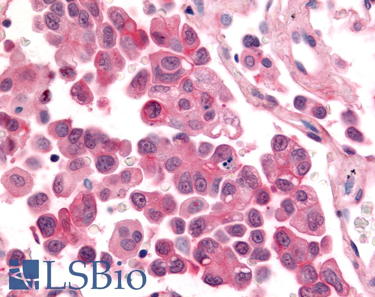 PathPlus™ Polyclonal Rabbit anti-Human CDK12 / CRKRS Antibody (Internal, IHC)