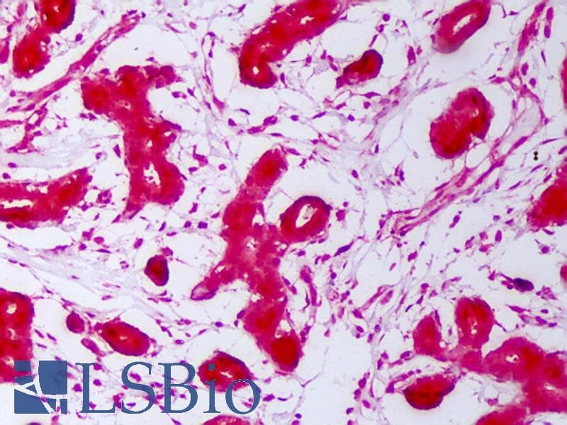IHC-plus™ HSP70 / Heat Shock Protein 70 Antibody (clone 3A3)