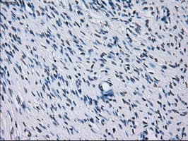 RNF144B Antibody (clone OTI9H10)