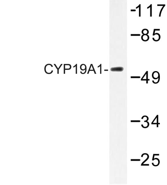 Polyclonal Rabbit anti-Human CYP19 / Aromatase Antibody (Lys243, IHC, IF, WB)
