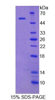 Human HAVCR1 / KIM-1 Protein (Recombinant His-T7)